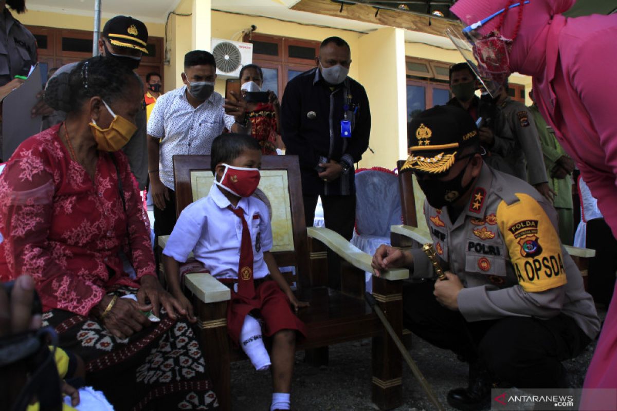 Kapolda NTT bantu kaki palsu untuk anak SD cacat sejak lahir