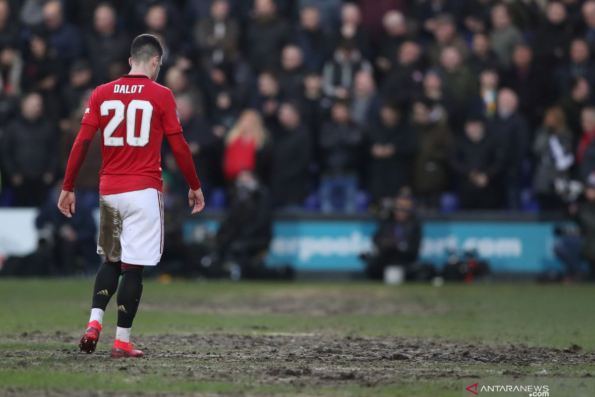 Dalot yakin MU akan mendapatkan perlawanan sengit dari Burnley