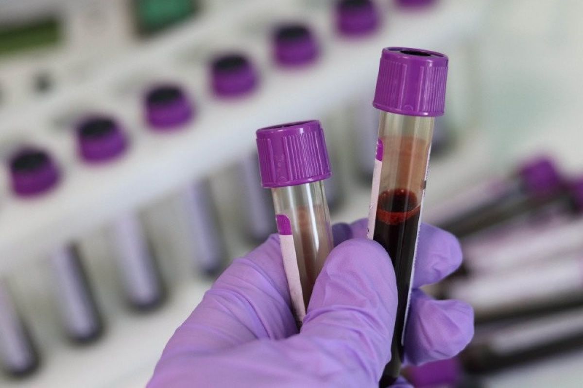Studi ungkap orang bergolongan darah O kecil kemungkinan untuk terkena COVID-19