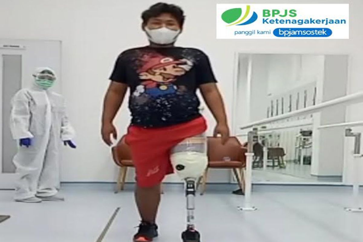 BPJAMSOSTEK berikan kaki palsu motivasi pekerja kembali bekerja