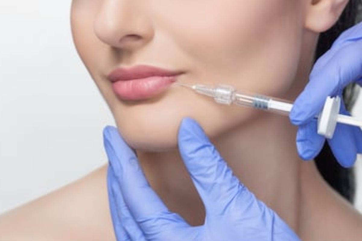 Pemilik kulit kering dianjurkan pakai pelembap usai botox