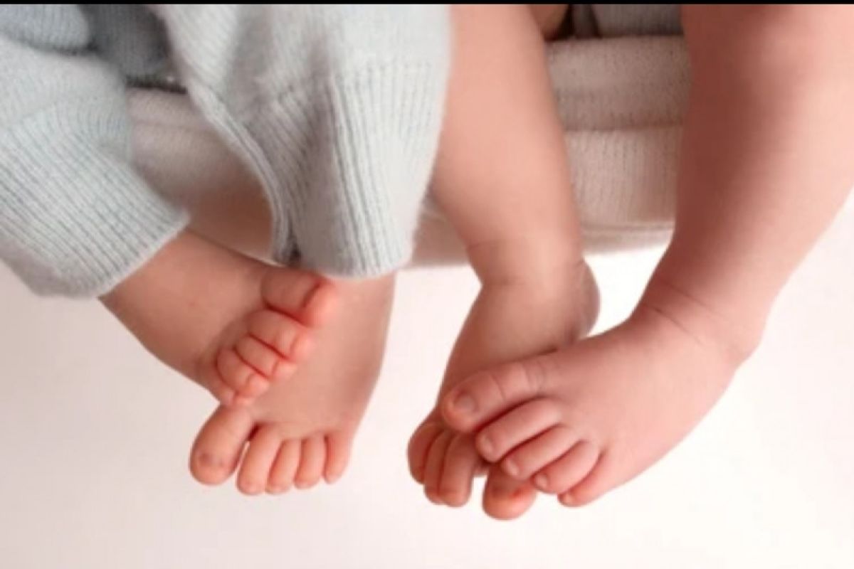 11 faktor penentu terjadinya kehamilan kembar