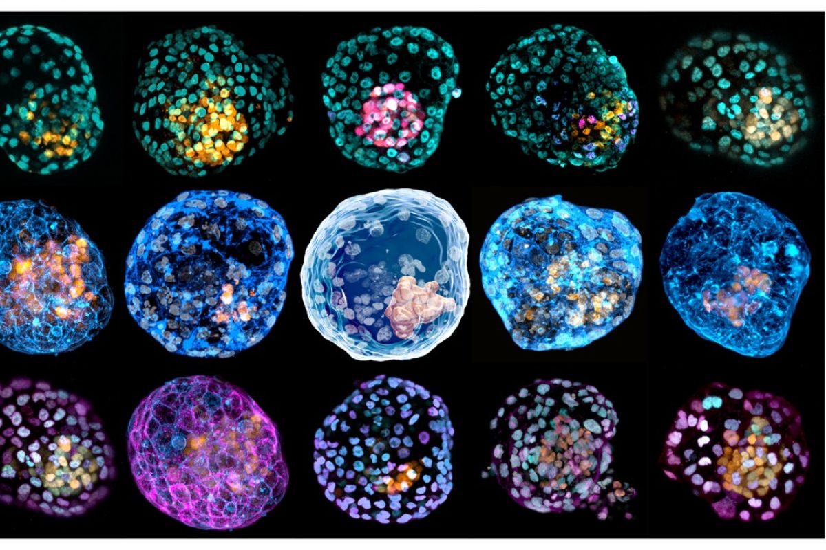 Tim ilmuwan temukan iBlastoid sebagai terobosan studi perkembangan manusia