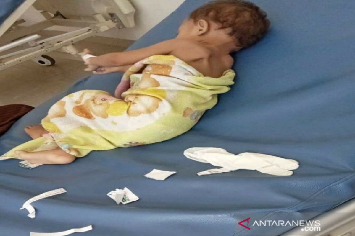 Ketua PKK Kendari bantu biaya pengobatan bayi penderita stenosis pilorus