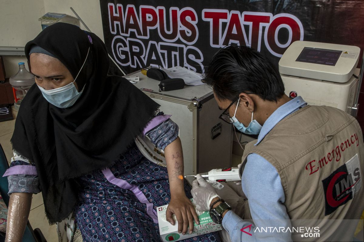 Pemkot Jakbar fasilitasi warga yang ingin hapus tato