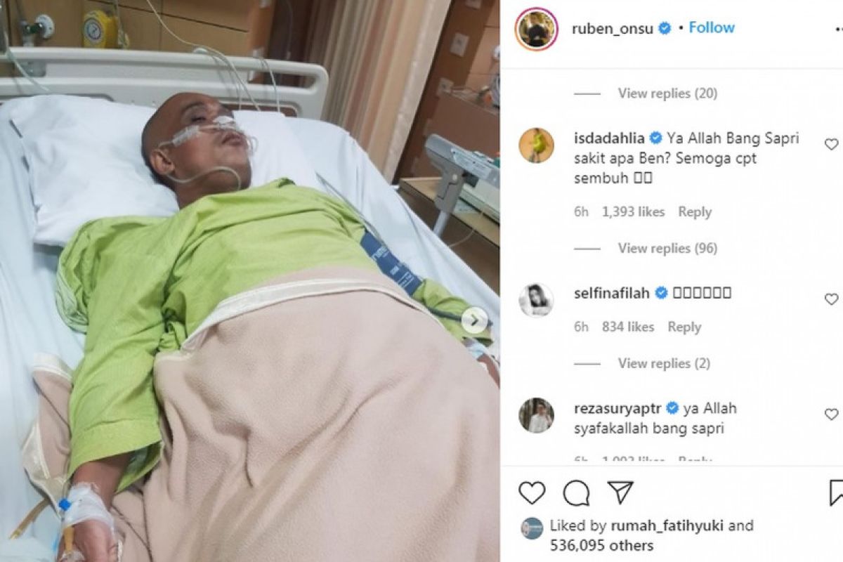 Istri mau melahirkan, komedian Sapri Pantun malah dilarikan ke ICU