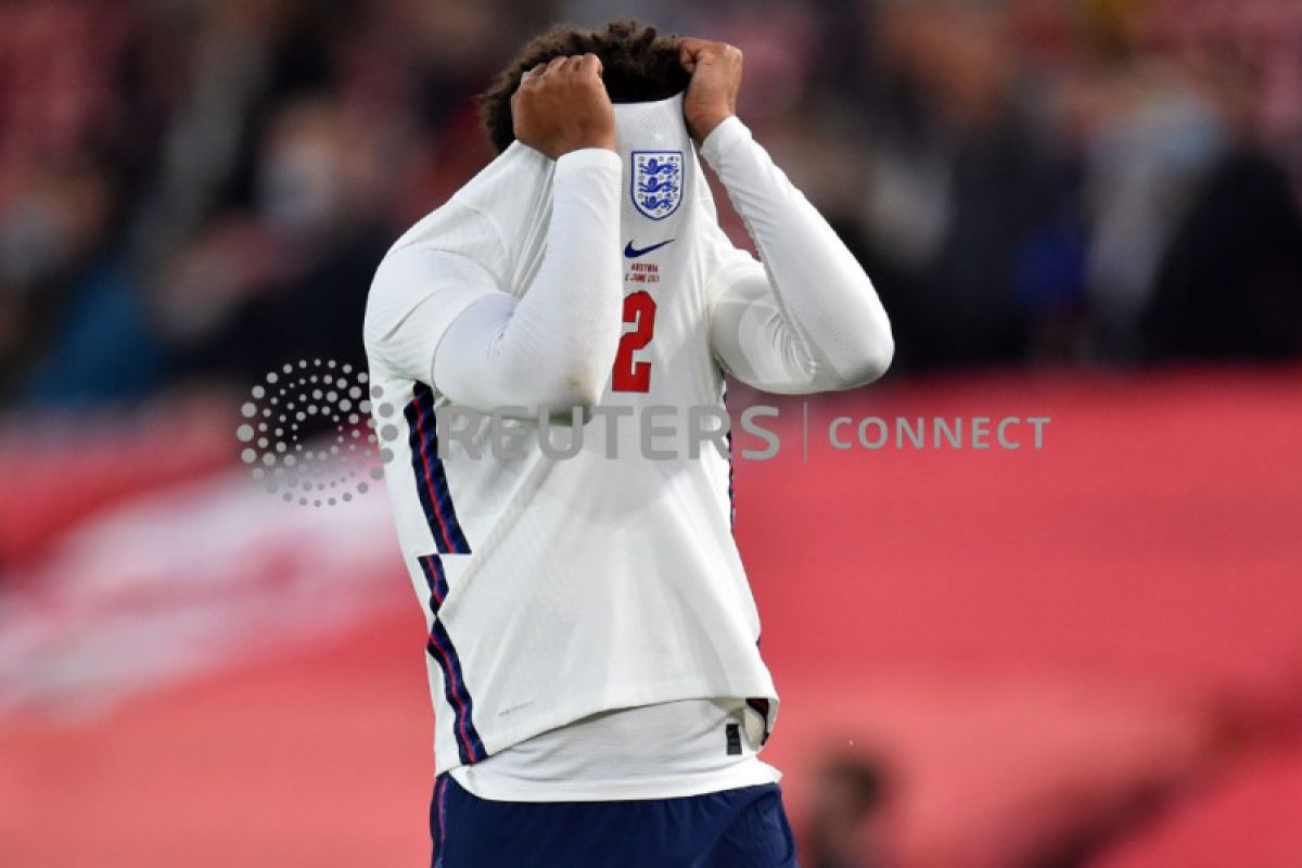 Trent Alexander-Arnold absen bela Inggris di EURO 2020 akibat cedera