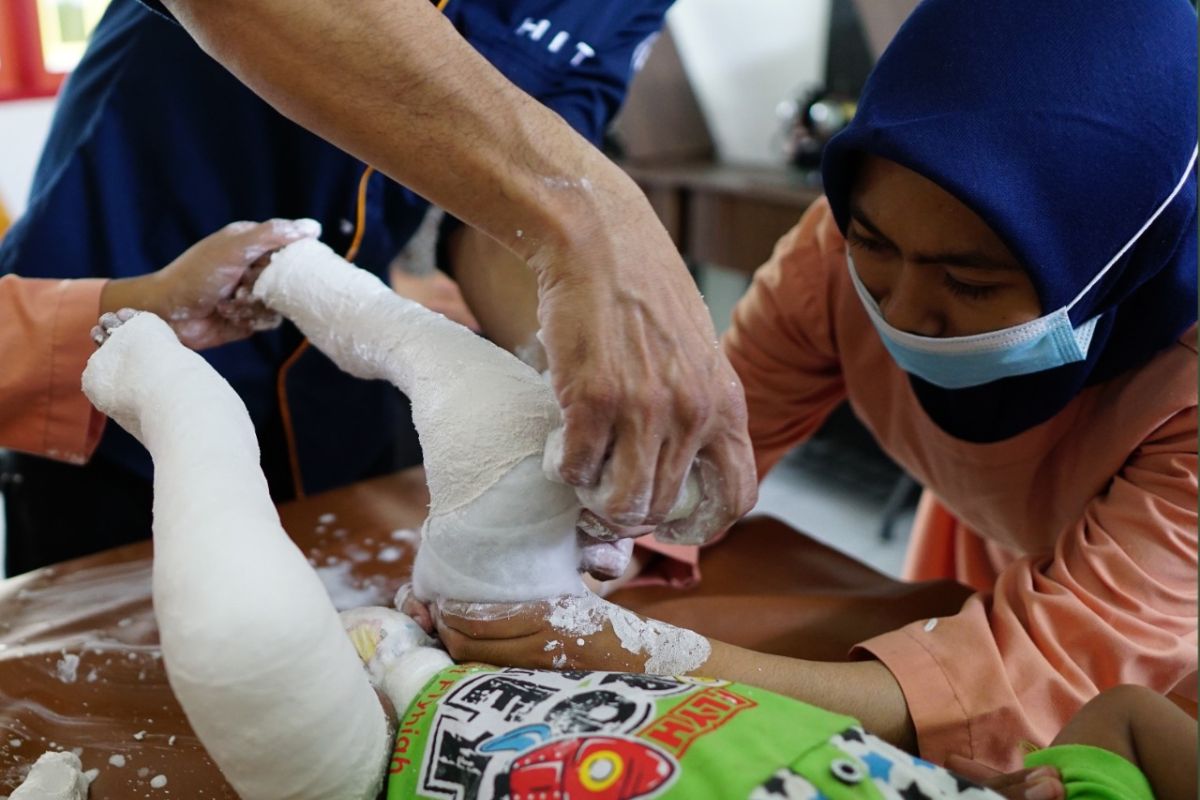 Ratusan anak di Lombok terlahir kaki pengkor, semoga tak terjadi di Ambon