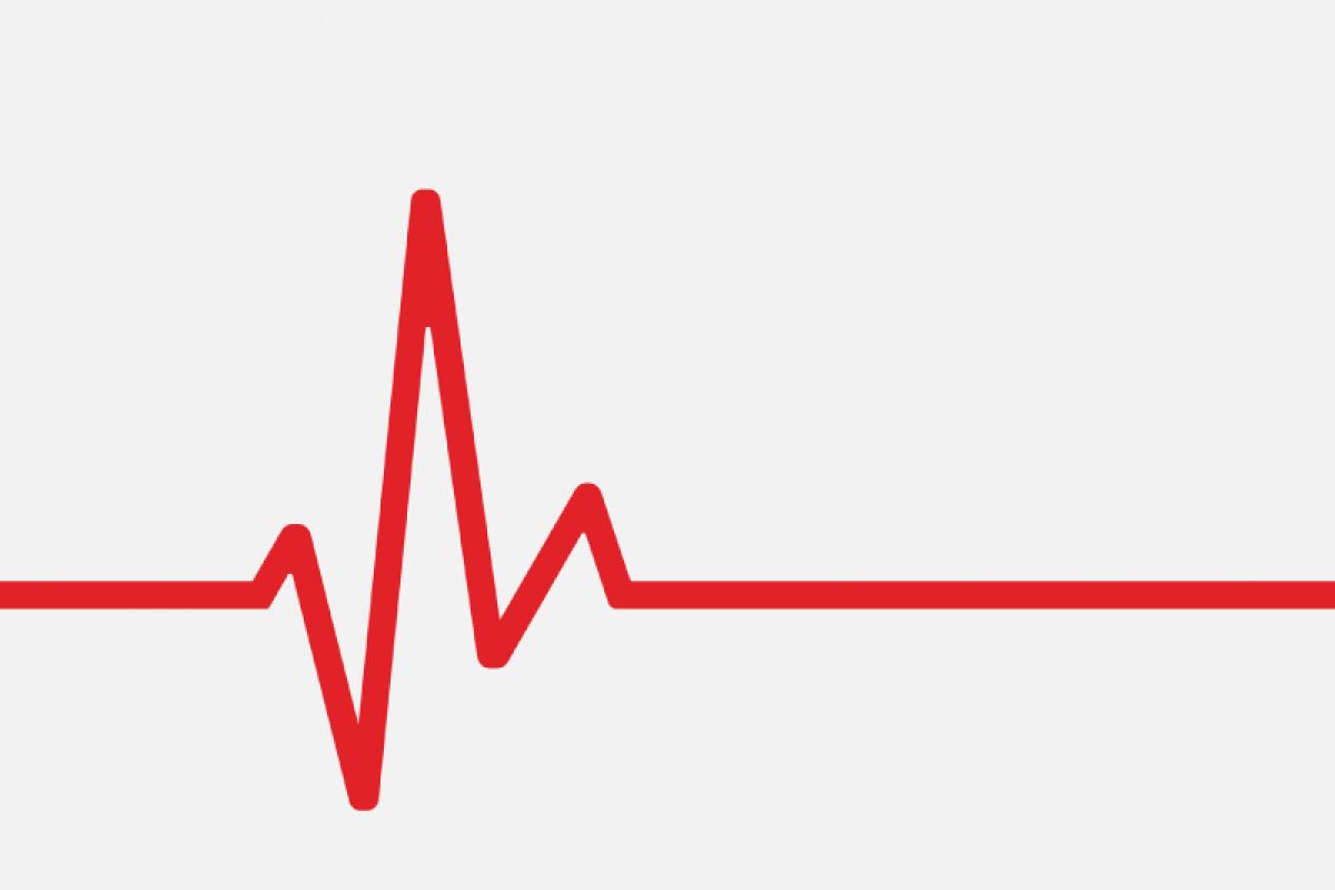 Waspadai irama detak jantung yang tak beraturan