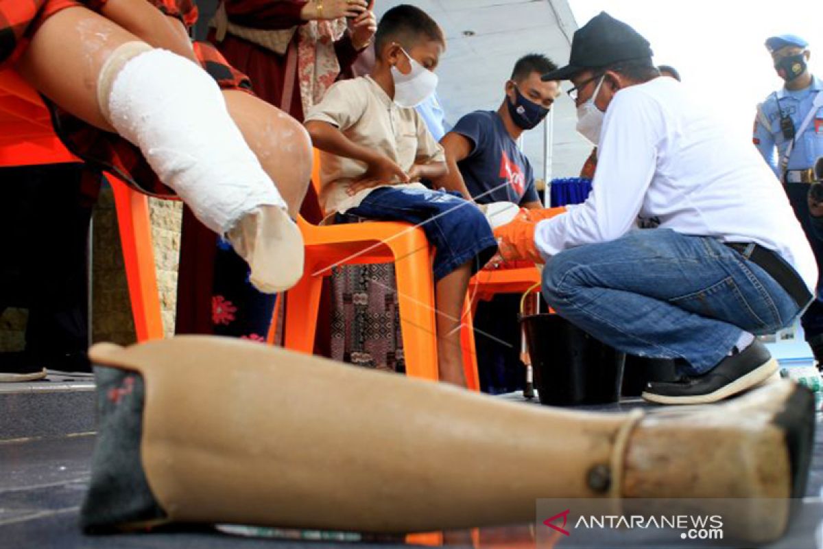 Ini dia difabel penerima bantuan  kaki palsu di Aceh