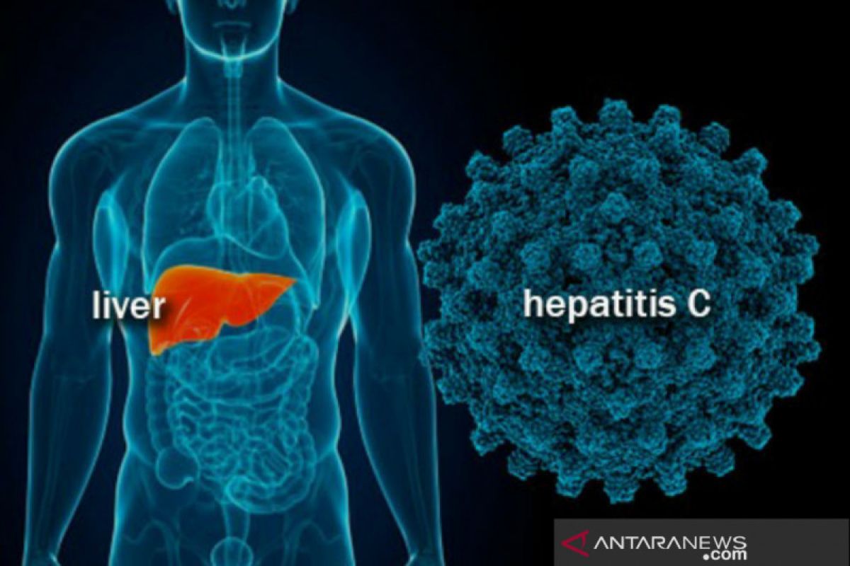 Dinkes Kota Bogor laksanakan sejumlah program penanganan hepatitis