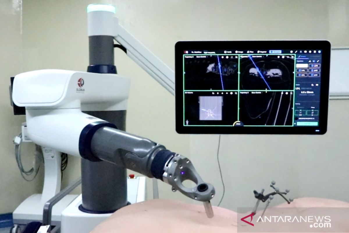 Eka hospital hadirkan robot navigasi satu-satunya di Indonesia untuk obati skoliosis