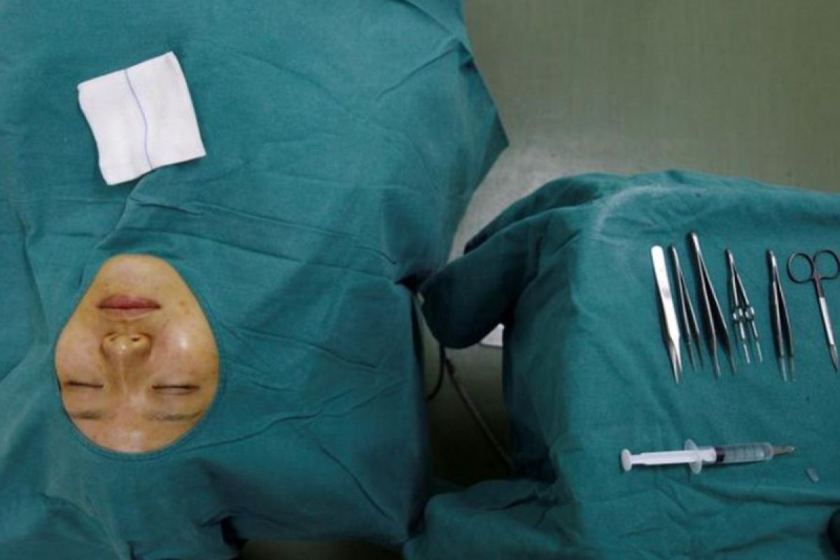 Koran pemerintah China kecam iklan kecantikan medis