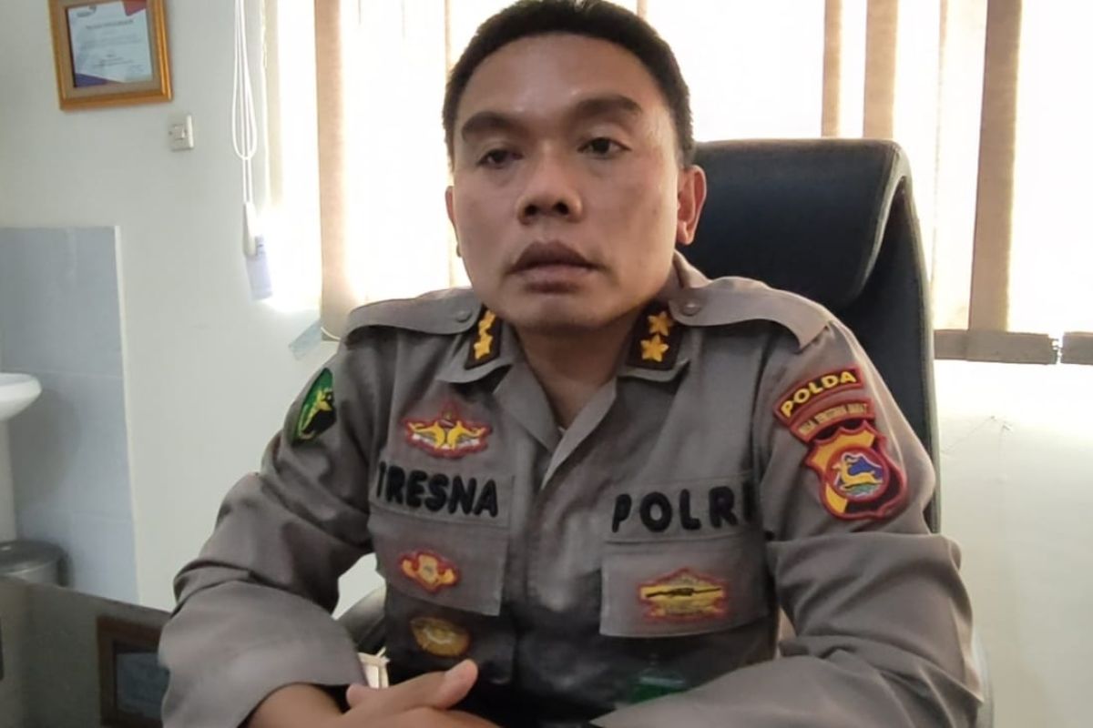 Polda NTB akan gelar bakti sosial Operasi bibir sumbing gratis bagi warga NTB