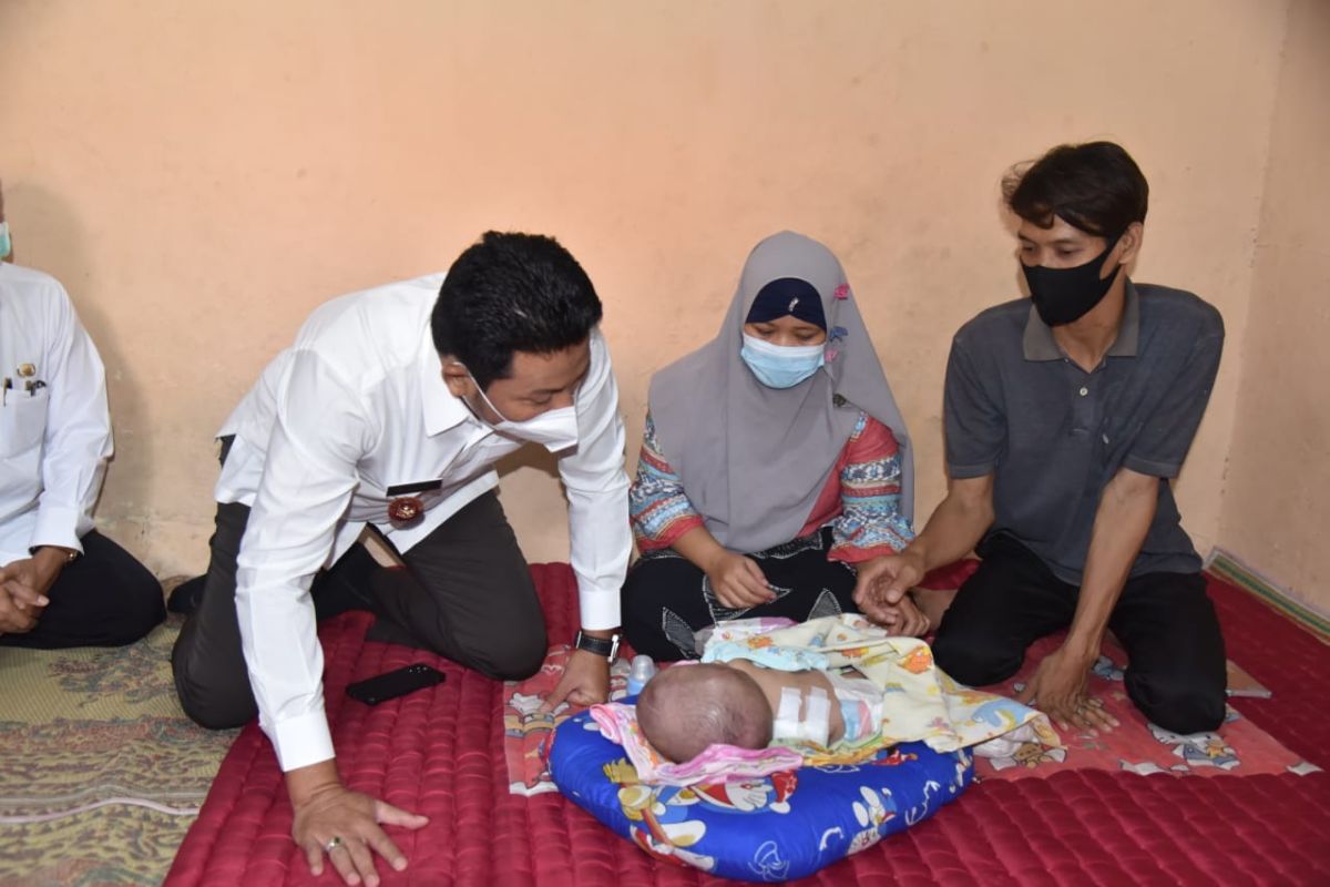 Pemkab Sidoarjo bantu biaya pengobatan bayi penderita hidrosefalus