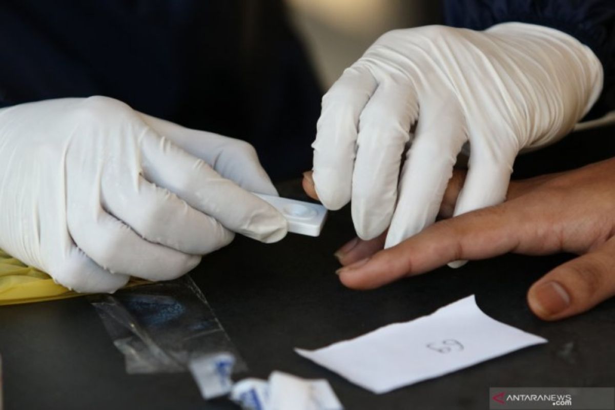 Tes HIV pada populasi berisiko di Kota Surabaya diminta digalakkan pada 2022