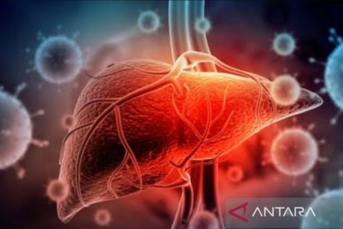 Anggota DPR usulkan dua langkah atasi hepatitis akut