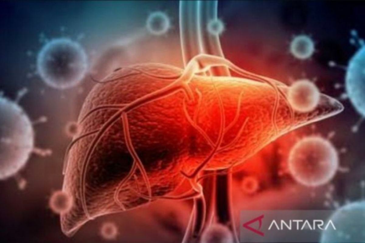 Dokter ungkap gejala awal terjangkit hepatitis