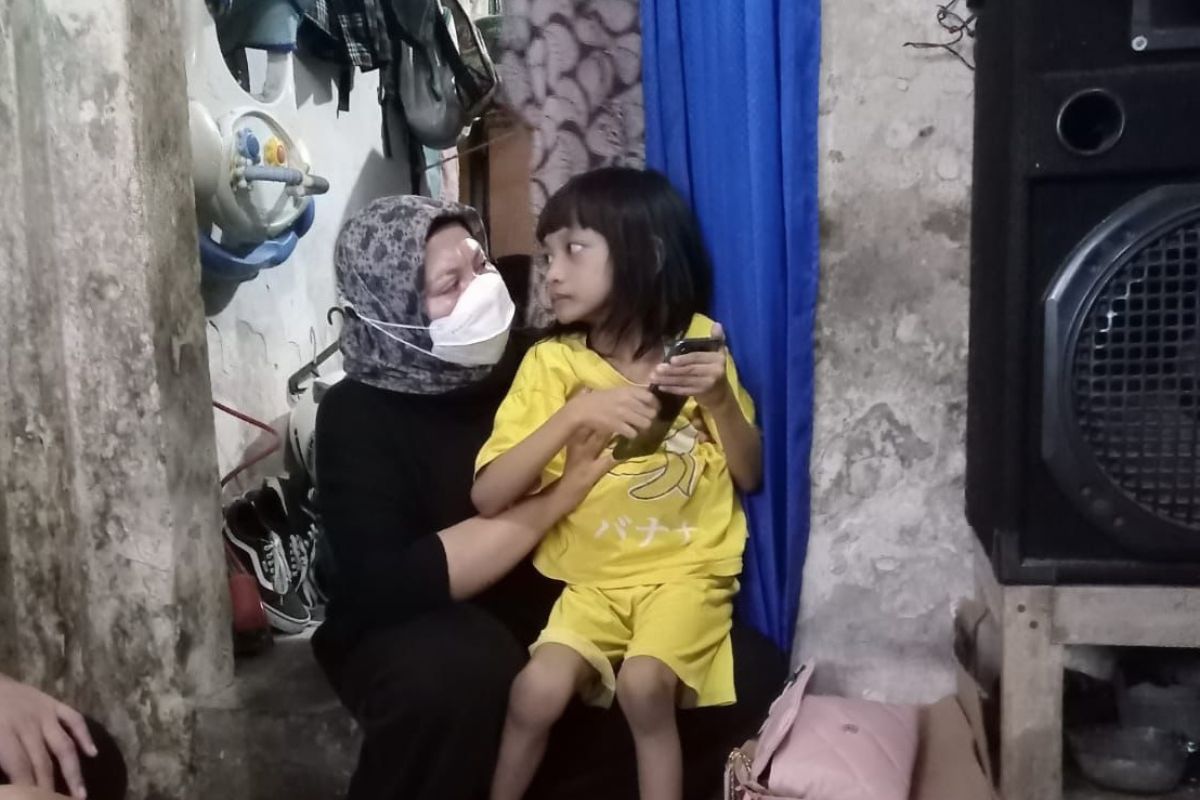 Anak tujuh tahun di Surabaya tak bisa jalan membutuhkan perhatian