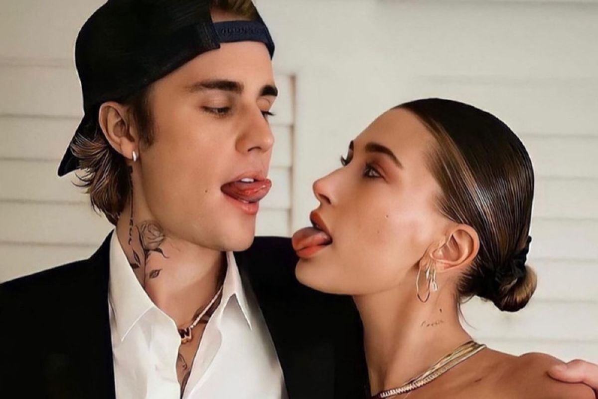 Wajah Justin Bieber didiagnosis lumpuh sebelah, Hailey beri dukungan