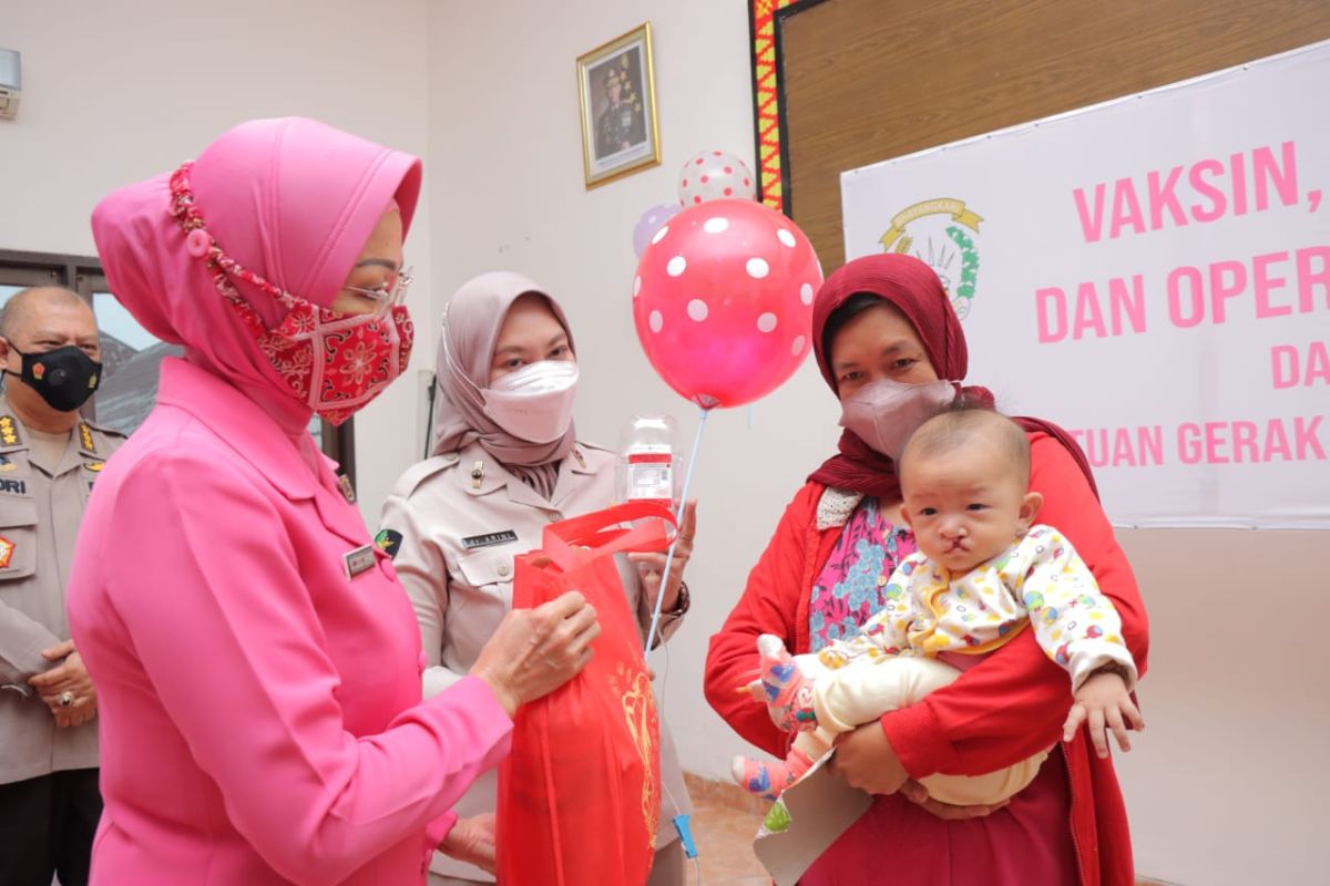 Hari Bhayangkari, 34 balita di Lampung jalani operasi bibir sumbing