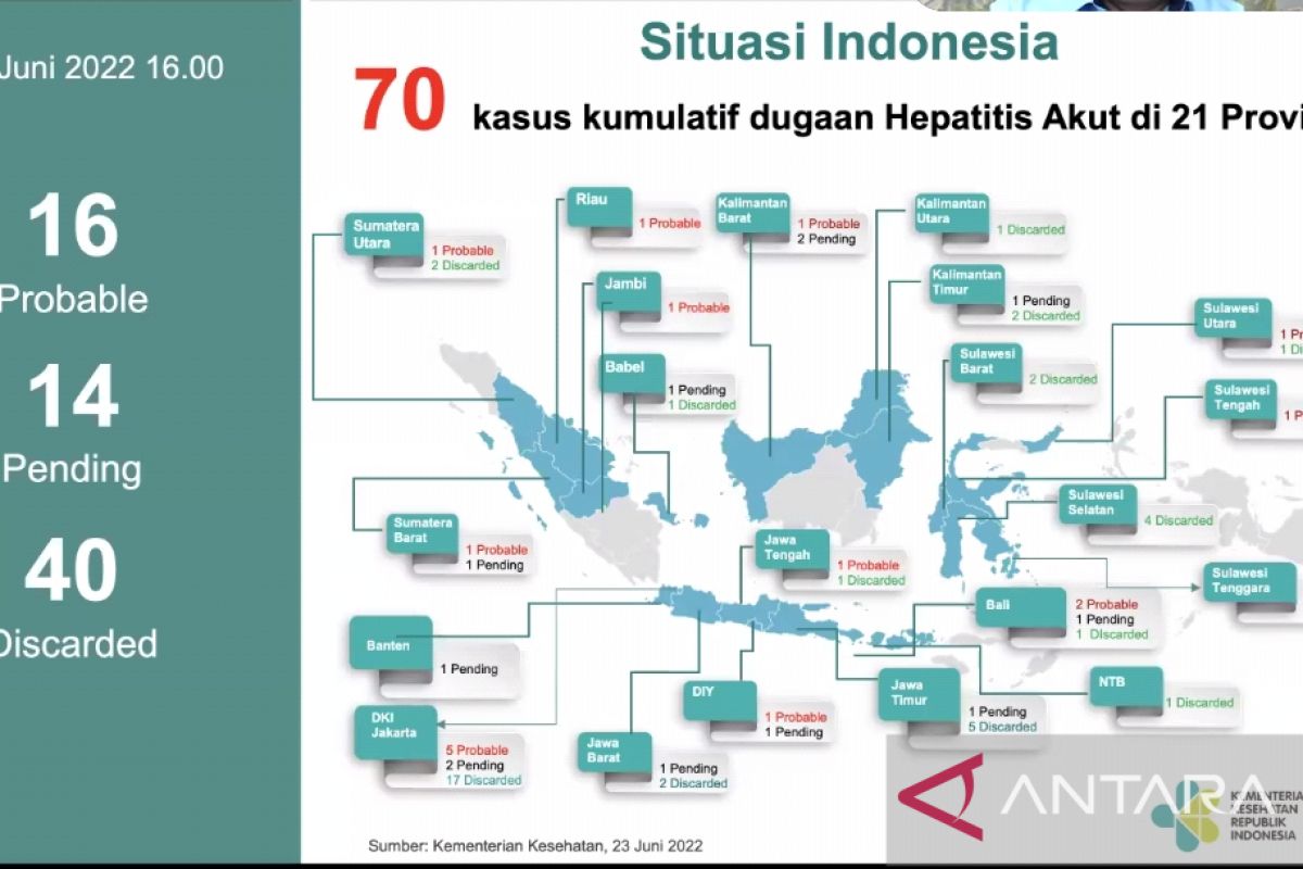 Indonesia records 70 suspected acute hepatitis cases: ministry