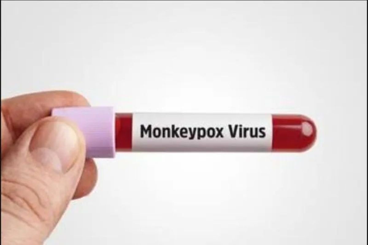 AS izinkan metode injeksi baru untuk vaksin cacar monyet