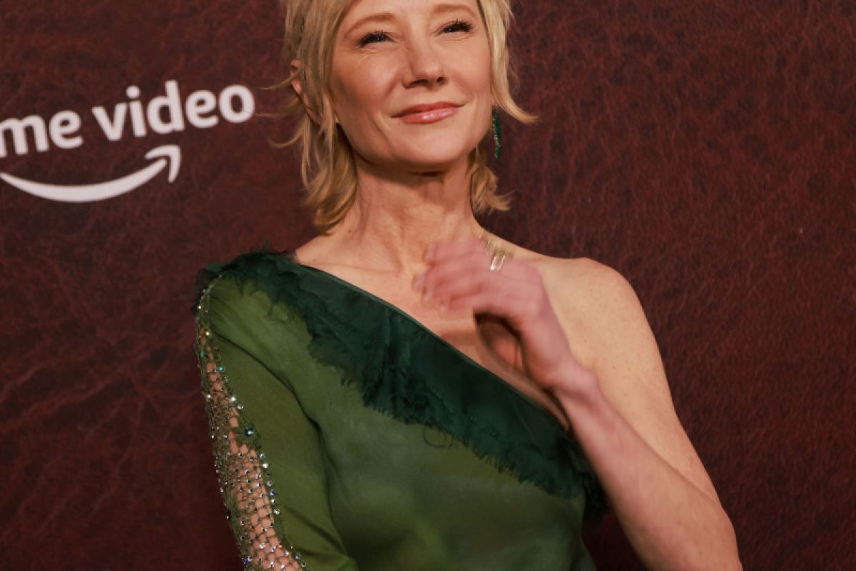 Kecelakaan mobil, aktris Hollywood Anne Heche masih koma