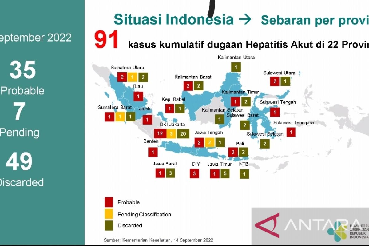 Kemenkes deteksi 91 kasus hepatitis akut misterius, di Lampung belum ditemukan