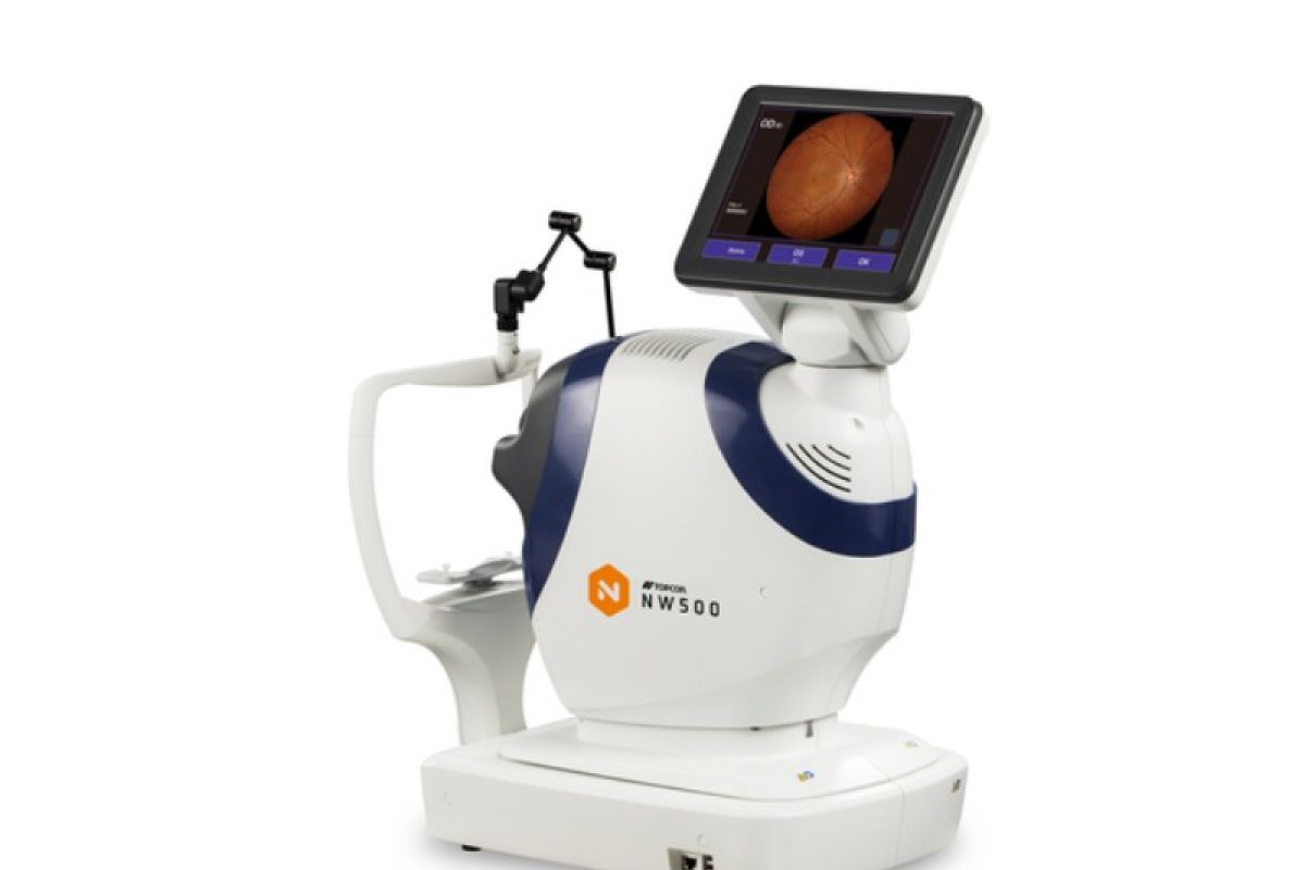 Topcon perkenalkan kamera retina non-mydriatic NW500