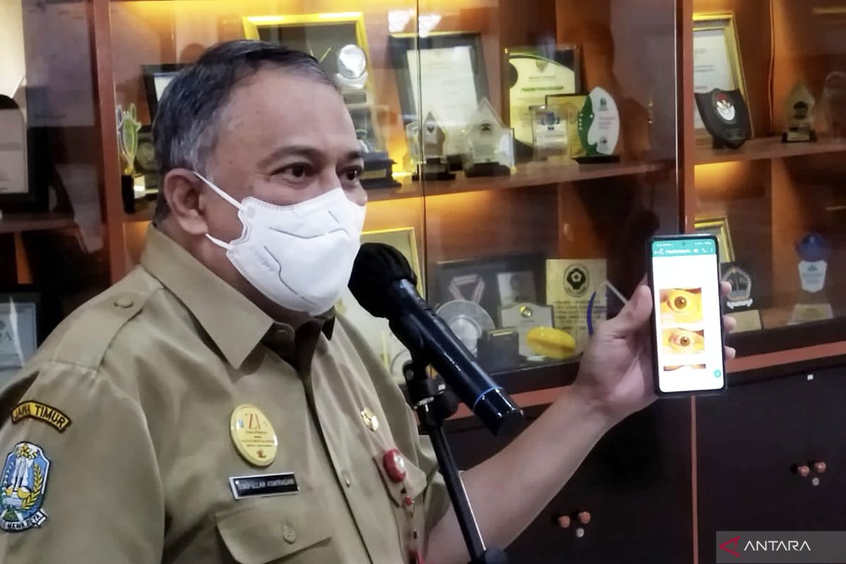 RSSA: Kondisi korban tragedi Kanjuruhan alami iritasi mata mulai membaik