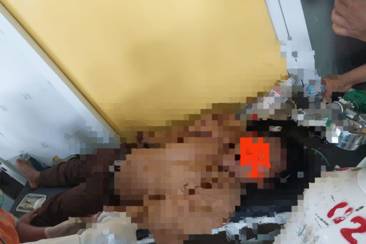 Motor vs mobil tabrakan di jalan lintas Bolo-Soromandi, pelajar tewas