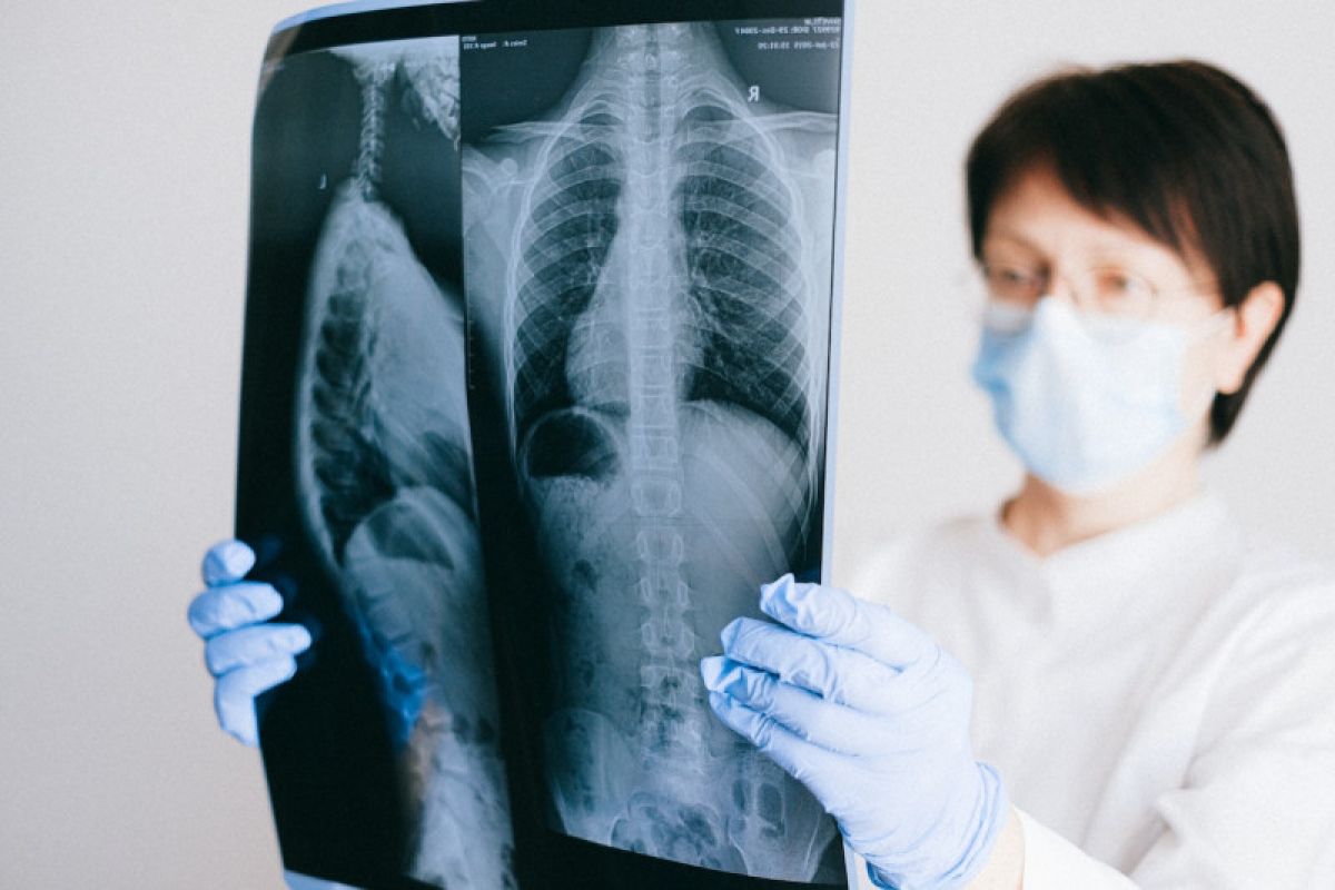 Kemenkes imbau masyarakat tidak panik sikapi wabah pneumonia di China