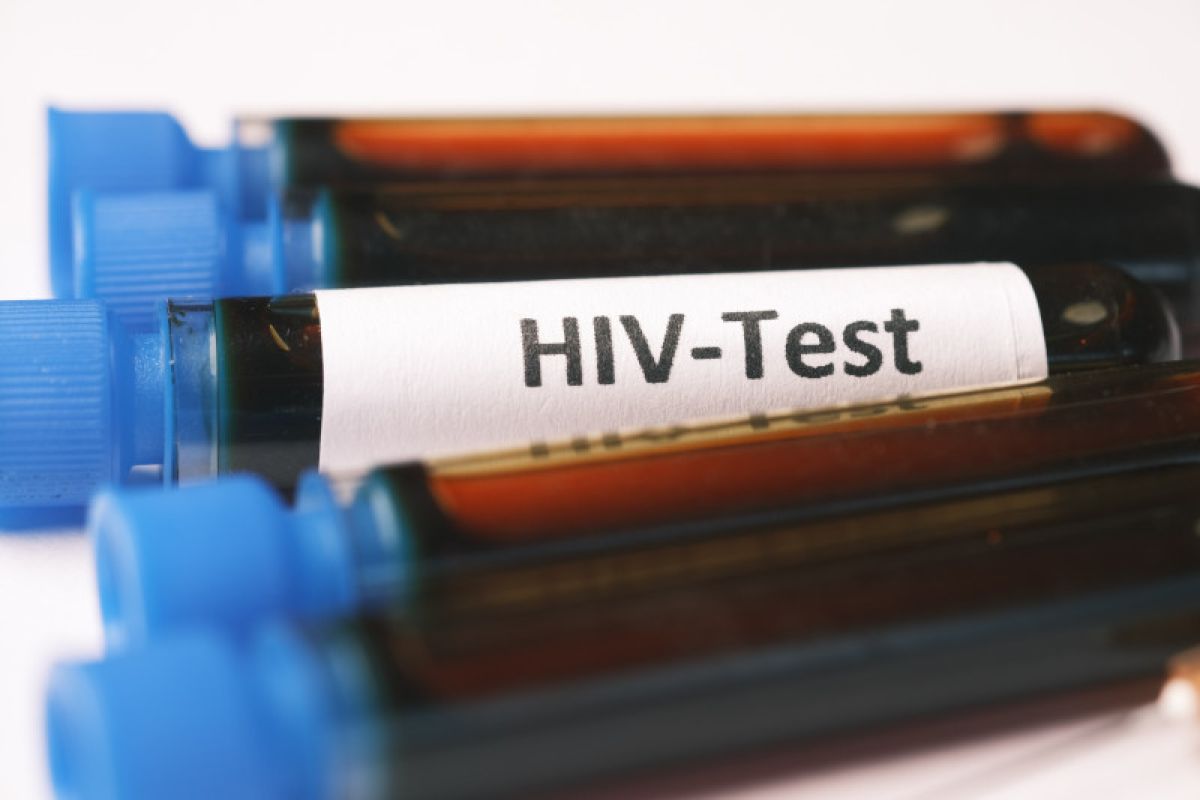 Dokter mengajak masyarakat tidak takut tes HIV