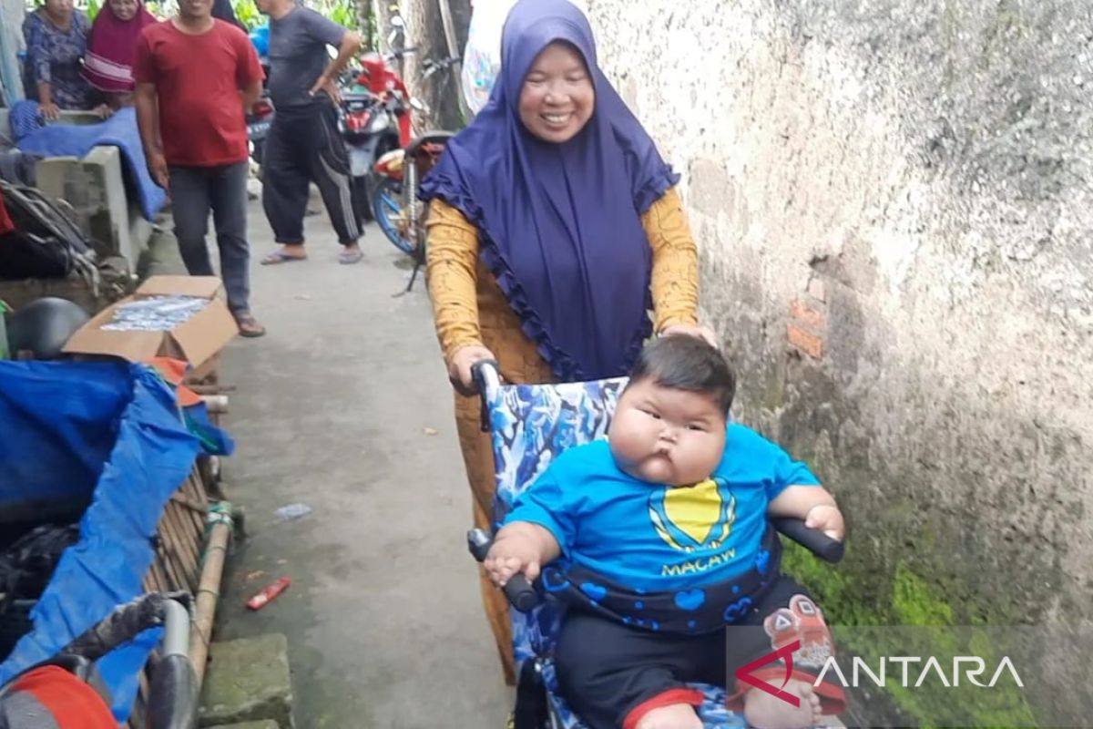 Balita obesitas asal Bekasi dirujuk ke rumah sakit