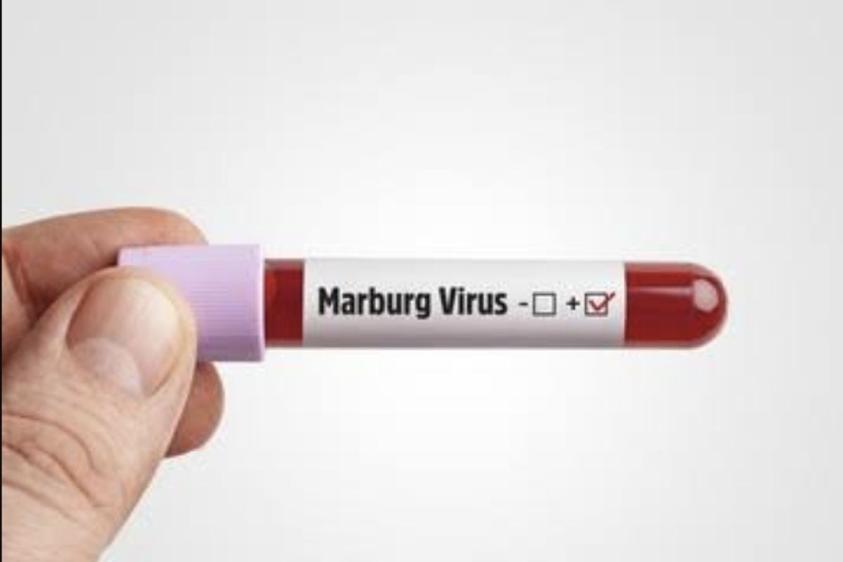 Kemenkes tingkatkan kewaspadaan penyakit Marburg asal Guinea
