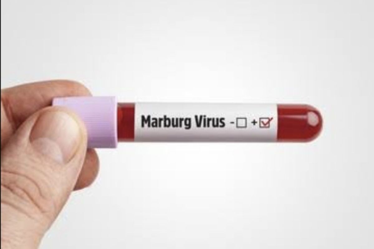 Masyarakat diminta tak kunjungi negara terjangkit virus Marburg