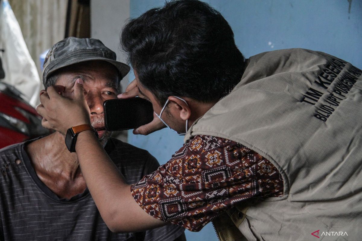 Awas, obat tetes mata herbal dapat sebabkan kebutaan