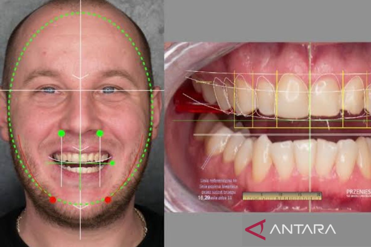 Dokter gigi: Dentistry 2.0 libatkan AI dalam praktiknya