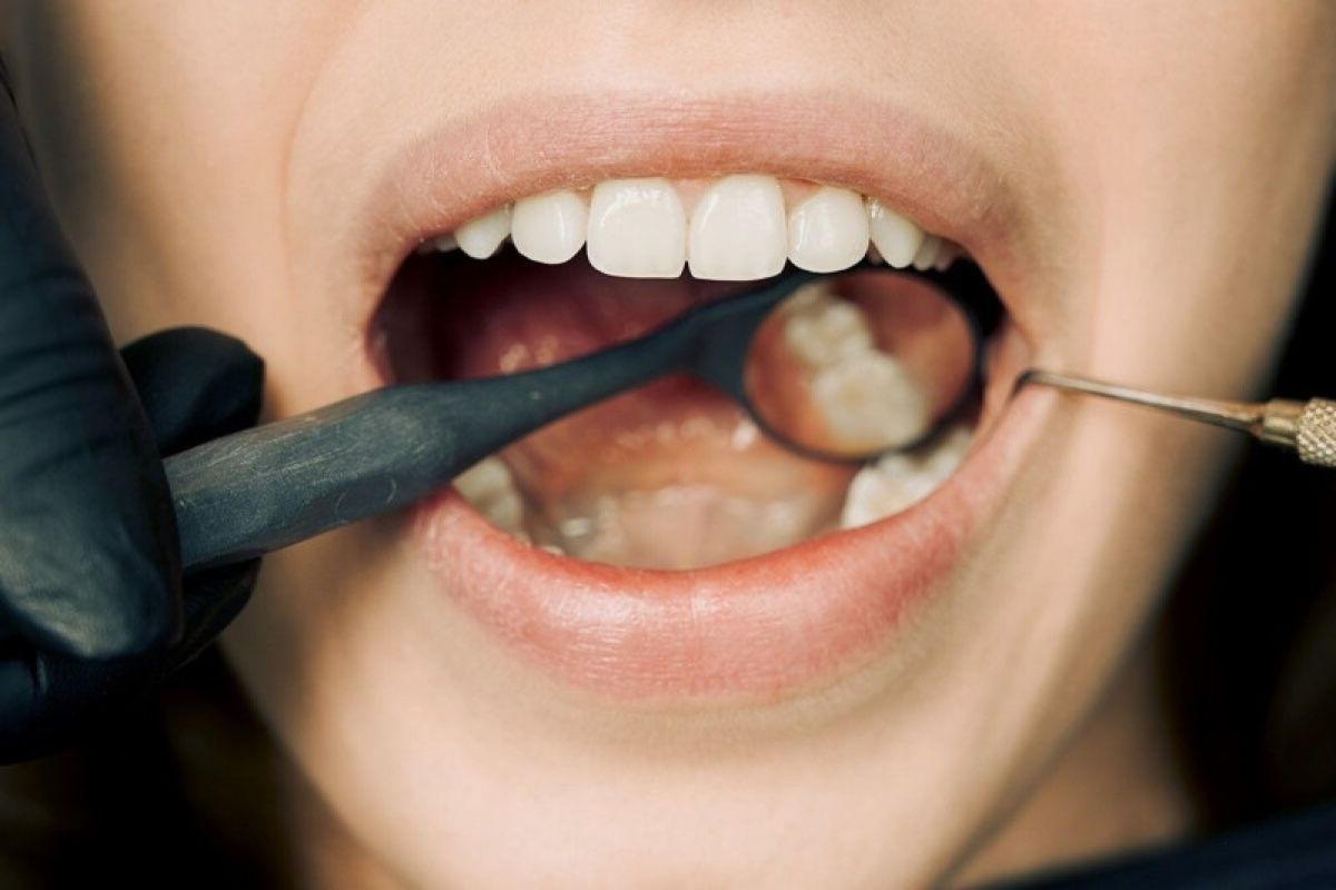 Cara menjaga kesehatan gigi dan mulut selama berpuasa