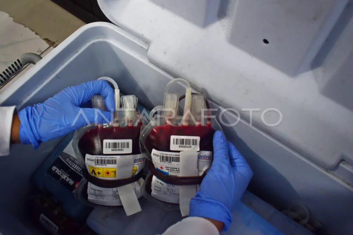 Ahli hematologi onkologi: 1 pendonor darah bisa selamatkan tiga nyawa