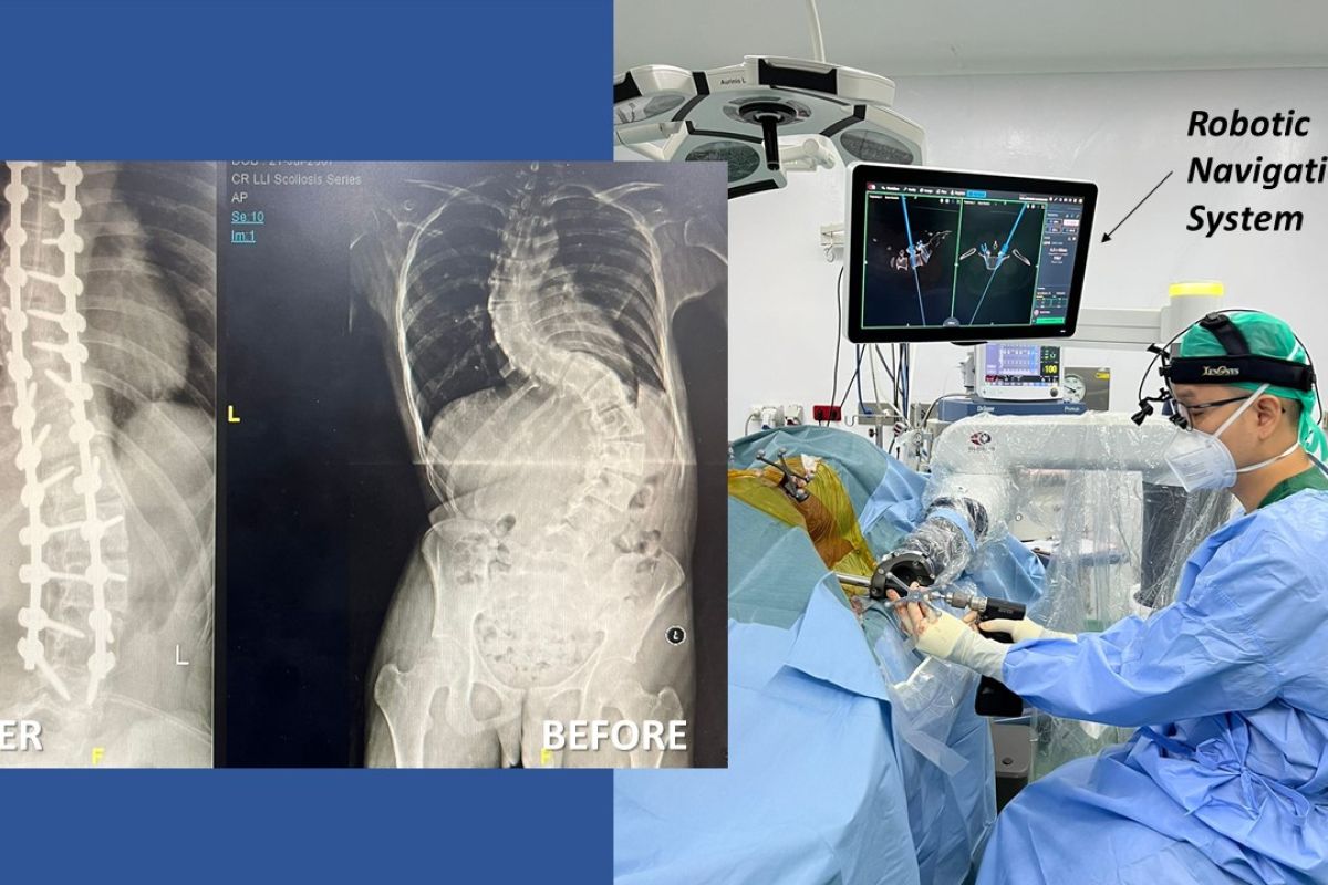 Spesialis tulang dr. Rizki Gatam: Teknologi bisa atasi saraf kejepit