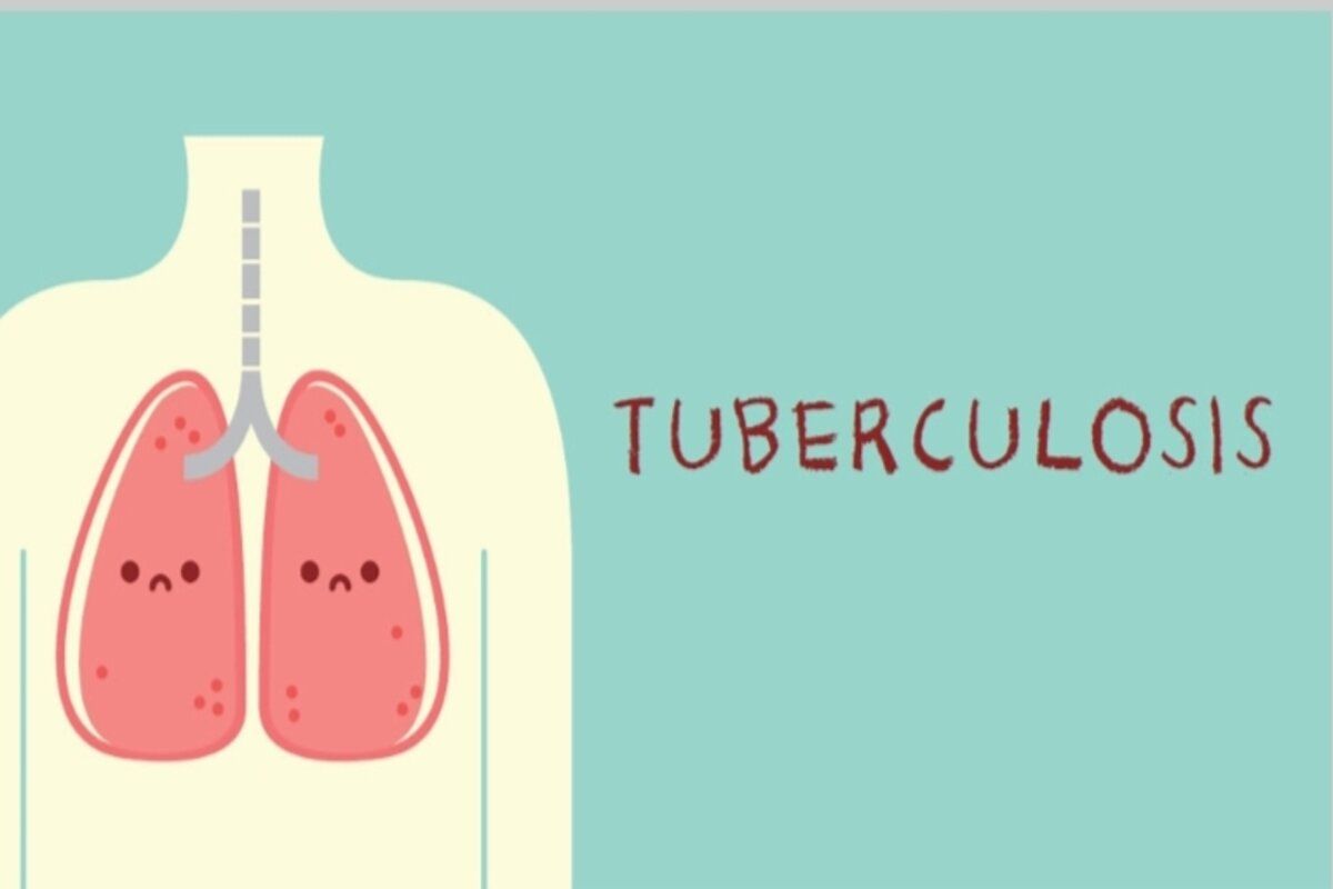 Strategi penanganan tuberkulosis di Indonesia dirumuskan