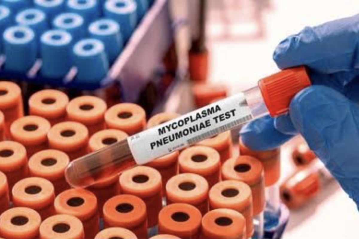 Kemenkes siapkan jejaring laboratorium pendeteksi mycoplasma pneumonia