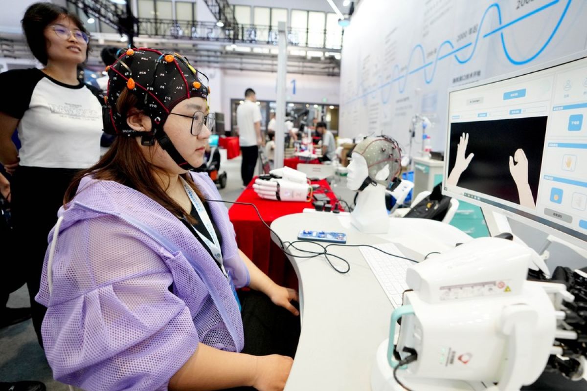 Peneliti China temukan elektrode saraf baru untuk pengobatan stroke