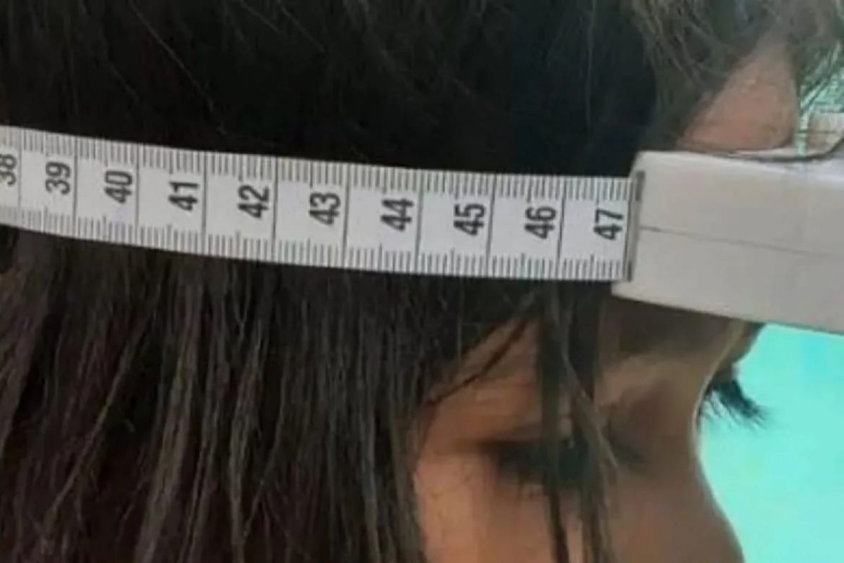 Dokter: Ukur lingkar kepala anak secara rutin untuk deteksi tumor