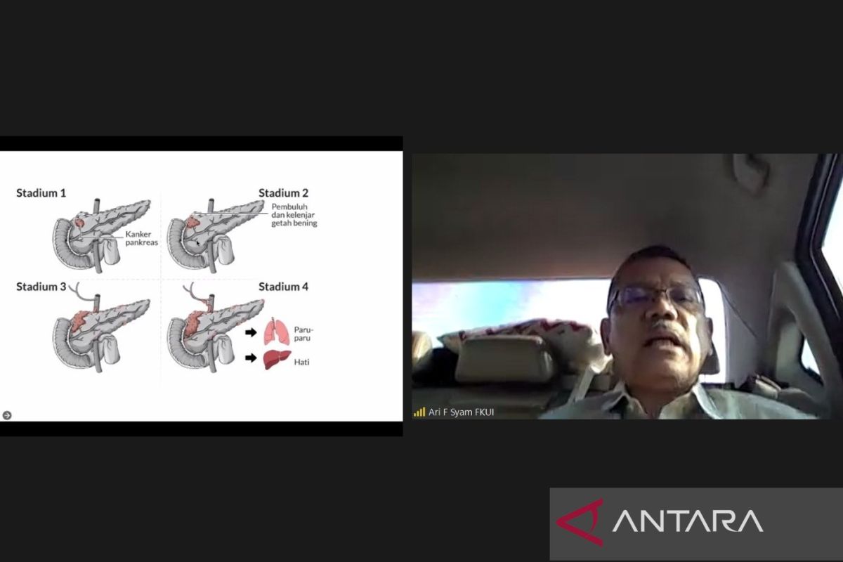 Pakar: Waspada kanker pankreas bisa terjadi tanpa gejala