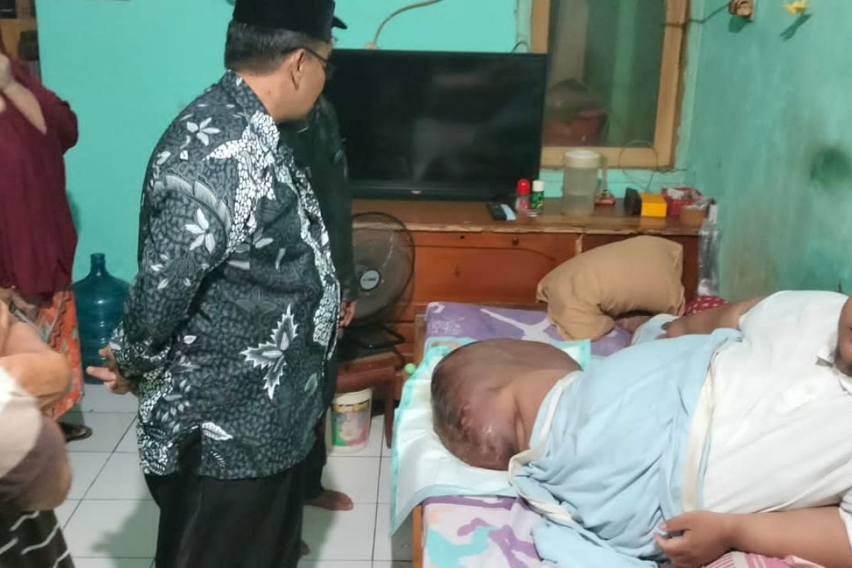 Engky penderita lymphedema di Tangerang butuh bantuan