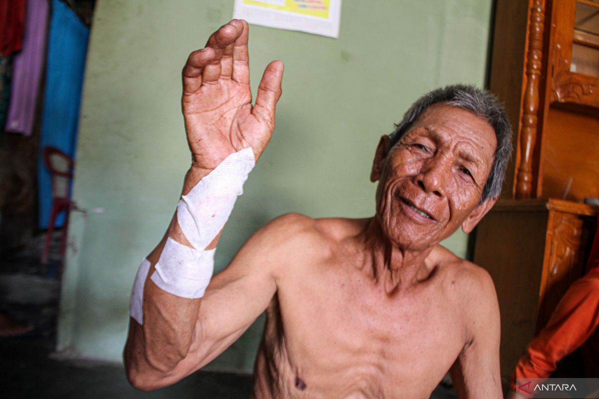 Terluka, Seorang pria di Lampung Selatan diserang Buaya