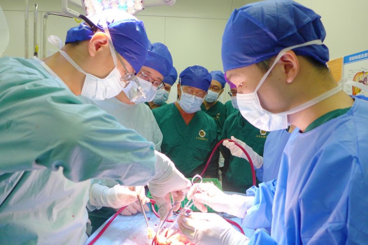Teknologi transplantasi organ China maksimalkan potensi organ donor